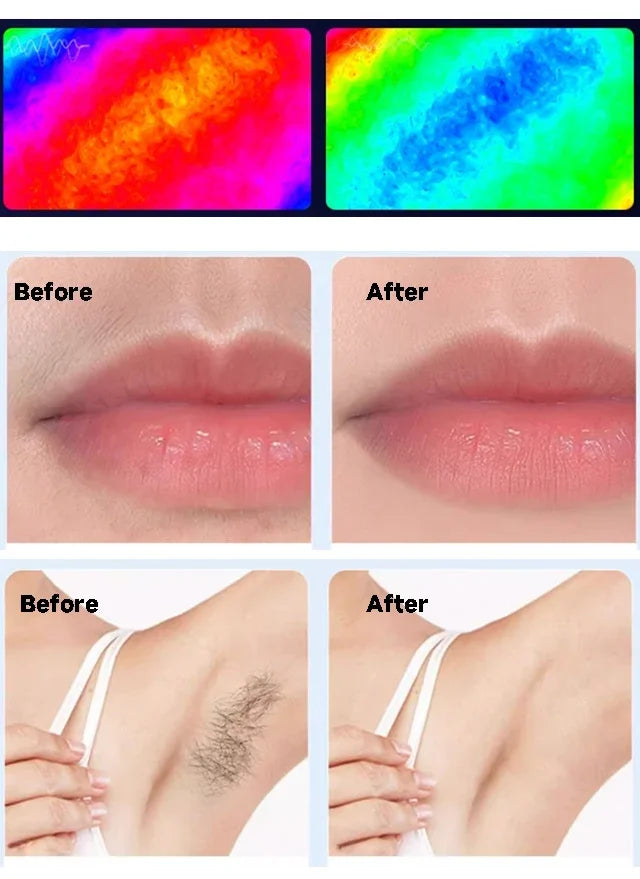 IPL Hair Removal Device 999999 Flashes Permanent Epilator Body Treament Home Use for Women Men Facial Shaver Cutting Machine