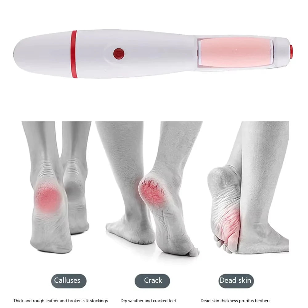 Electric Foot Grinder Auto Wireless Remove Dead Skin Calluses Cracks Hard Cracked skin Pedicure Tool Waterproof Foot Cleaner